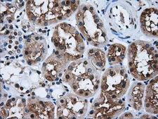 HDAC10 Antibody - Immunohistochemical staining of paraffin-embedded Kidney tissue using anti-HDAC10 mouse monoclonal antibody. (Dilution 1:50).