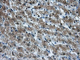 HDAC10 Antibody - Immunohistochemical staining of paraffin-embedded liver tissue using anti-HDAC10 mouse monoclonal antibody. (Dilution 1:50).