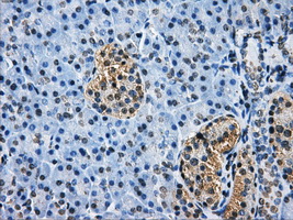 HDAC10 Antibody - Immunohistochemical staining of paraffin-embedded pancreas tissue using anti-HDAC10 mouse monoclonal antibody. (Dilution 1:50).