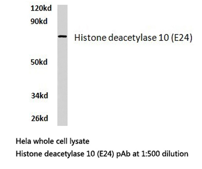 HDAC10 Antibody - Western blot of HDAC10 (E24) pAb in extracts from HeLa cells.
