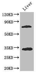 HDAC10 Antibody - Positive WB detected in:Mouse liver tissue;All lanes: HDAC10 antibody at 3.4ug/ml;Secondary;Goat polyclonal to rabbit IgG at 1/50000 dilution;Predicted band size: 72,70,71,44 kDa;Observed band size: 72,34 kDa;