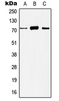 HDAC10 Antibody - Western blot analysis of Histone Deacetylase 10 expression in HeLa (A); Jurkat (B); mouse liver (C); rat liver (D) whole cell lysates.