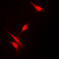 HDAC10 Antibody - Immunofluorescent analysis of Histone Deacetylase 10 staining in Jurkat cells. Formalin-fixed cells were permeabilized with 0.1% Triton X-100 in TBS for 5-10 minutes and blocked with 3% BSA-PBS for 30 minutes at room temperature. Cells were probed with the primary antibody in 3% BSA-PBS and incubated overnight at 4 C in a humidified chamber. Cells were washed with PBST and incubated with a DyLight 594-conjugated secondary antibody (red) in PBS at room temperature in the dark. DAPI was used to stain the cell nuclei (blue).