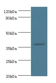 HDAC11 Antibody - Western blot. All lanes: HDAC11 antibody at 2 ug/ml+mouse brain tissue. Secondary antibody: Goat polyclonal to rabbit at 1:10000 dilution. Predicted band size: 39 kDa. Observed band size: 39 kDa.
