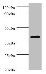 HDAC11 Antibody - Western blot All lanes: HDAC11 antibody at 2µg/ml + Mouse brain tissue Secondary Goat polyclonal to rabbit IgG at 1/10000 dilution Predicted band size: 40, 34 kDa Observed band size: 40 kDa