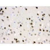 HDAC11 Antibody - HDAC11 antibody IHC-paraffin. IHC(P): Mouse Brain Tissue.