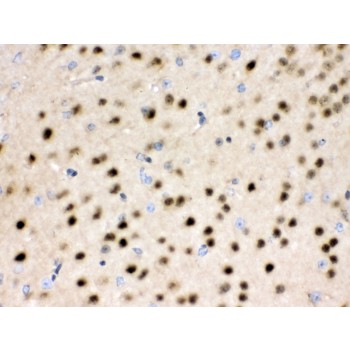 HDAC11 Antibody - HDAC11 antibody IHC-paraffin. IHC(P): Rat Brain Tissue.