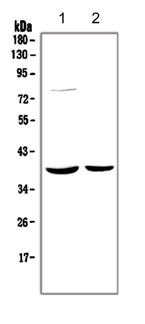HDAC11 Antibody - Western blot analysis of HDAC11 using anti-HDAC11 antibody. Electrophoresis was performed on a 5-20% SDS-PAGE gel at 70V (Stacking gel) / 90V (Resolving gel) for 2-3 hours. The sample well of each lane was loaded with 50ug of sample under reducing conditions. Lane 1: rat brain tissue lysate, Lane 2: mouse brain tissue lysate. After Electrophoresis, proteins were transferred to a Nitrocellulose membrane at 150mA for 50-90 minutes. Blocked the membrane with 5% Non-fat Milk/ TBS for 1.5 hour at RT. The membrane was incubated with rabbit anti-HDAC11 antigen affinity purified polyclonal antibody at 0.5 µg/mL overnight at 4°C, then washed with TBS-0.1% Tween 3 times with 5 minutes each and probed with a goat anti-rabbit IgG-HRP secondary antibody at a dilution of 1:10000 for 1.5 hour at RT. The signal is developed using an Enhanced Chemiluminescent detection (ECL) kit with Tanon 5200 system. A specific band was detected for HDAC11 at approximately 40KD. The expected band size for HDAC11 is at 40KD.