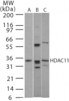HDAC11 Antibody - Western blot of HDAC11 in (A) human, (B) mouse and (C) rat brain tissue using antibody at 2 ug/ml.