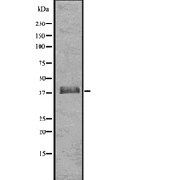 HDAC11 Antibody - Western blot analysis of HDAC11 using COLO205 whole cells lysates