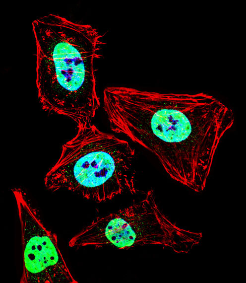HDAC2 Antibody - Fluorescent confocal image of HeLa cell stained with HDAC2 Antibody. HeLa cells were fixed with 4% PFA (20 min), permeabilized with Triton X-100 (0.1%, 10 min), then incubated with HDAC2 primary antibody (1:25, 1 h at 37°C). For secondary antibody, Alexa Fluor 488 conjugated donkey anti-rabbit antibody (green) was used (1:400, 50 min at 37°C). Cytoplasmic actin was counterstained with Alexa Fluor 555 (red) conjugated Phalloidin (7units/ml, 1 h at 37°C). Nuclei were counterstained with DAPI (blue) (10 ug/ml, 10 min). HDAC2 immunoreactivity is localized to Nucleus significantly.