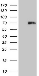 HDAC2 Antibody - HEK293T cells were transfected with the pCMV6-ENTRY control. (Left lane) or pCMV6-ENTRY HDAC2. (Right lane) cDNA for 48 hrs and lysed. Equivalent amounts of cell lysates. (5 ug per lane) were separated by SDS-PAGE and immunoblotted with anti-HDAC2. (1:2000)