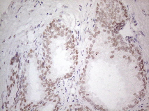 HDAC2 Antibody - Immunohistochemical staining of paraffin-embedded Human prostate tissue within the normal limits using anti-HDAC2 mouse monoclonal antibody. (Heat-induced epitope retrieval by 1mM EDTA in 10mM Tris buffer. (pH8.5) at 120°C for 3 min. (1:150)