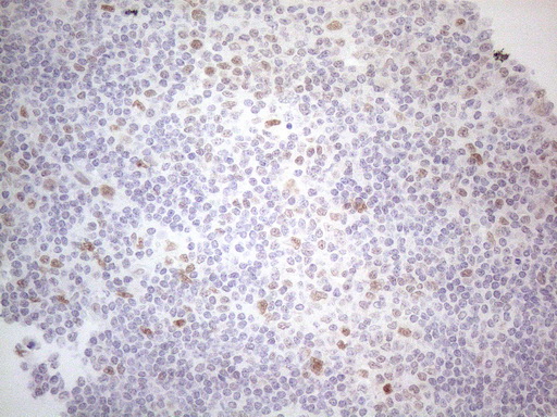 HDAC2 Antibody - Immunohistochemical staining of paraffin-embedded Human lymph node tissue within the normal limits using anti-HDAC2 mouse monoclonal antibody. (Heat-induced epitope retrieval by 1mM EDTA in 10mM Tris buffer. (pH8.5) at 120°C for 3 min. (1:150)