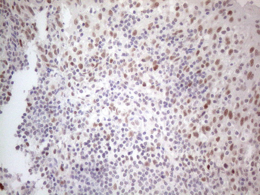 HDAC2 Antibody - Immunohistochemical staining of paraffin-embedded Human tonsil within the normal limits using anti-HDAC2 mouse monoclonal antibody. (Heat-induced epitope retrieval by 1mM EDTA in 10mM Tris buffer. (pH8.5) at 120°C for 3 min. (1:150)