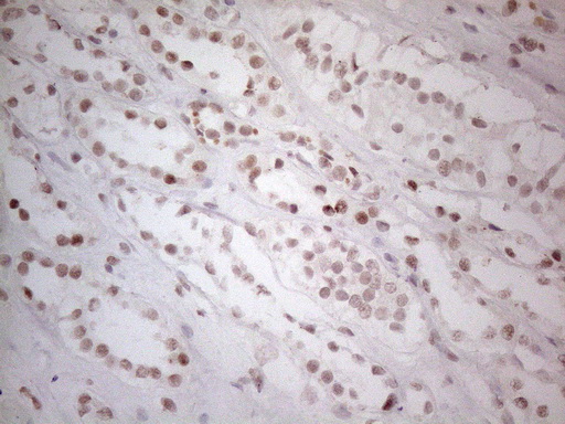 HDAC2 Antibody - Immunohistochemical staining of paraffin-embedded Human Kidney tissue within the normal limits using anti-HDAC2 mouse monoclonal antibody. (Heat-induced epitope retrieval by 1mM EDTA in 10mM Tris buffer. (pH8.5) at 120°C for 3 min. (1:150)