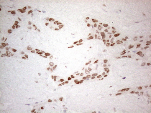 HDAC2 Antibody - Immunohistochemical staining of paraffin-embedded Human liver tissue within the normal limits using anti-HDAC2 mouse monoclonal antibody. (Heat-induced epitope retrieval by 1mM EDTA in 10mM Tris buffer. (pH8.5) at 120°C for 3 min. (1:150)
