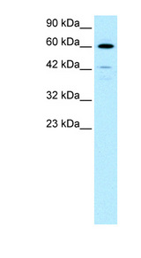 HDAC2 Antibody - HDAC2 antibody Western blot of Jurkat lysate. This image was taken for the unconjugated form of this product. Other forms have not been tested.
