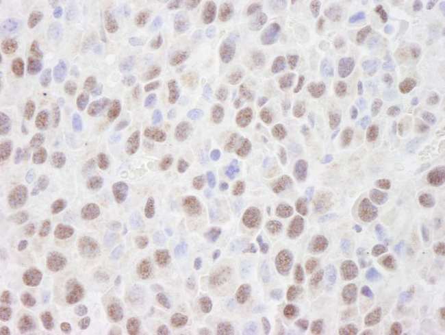 HDAC2 Antibody - Detection of Mouse HDAC2 by Immunohistochemistry. Sample: FFPE section of mouse squamous cell carcinoma. Antibody: Affinity purified rabbit anti-HDAC2 used at a dilution of 1:250. Detection: DAB.