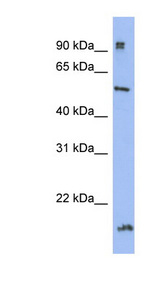 HDAC2 Antibody - HDAC2 antibody Western blot of HT1080 cell lysate. This image was taken for the unconjugated form of this product. Other forms have not been tested.