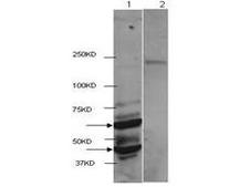 HDAC2 Antibody - Western Blot of Rabbit anti-HDAC2 antibody. Lane 1: mouse brain extract. Lane 2: mouse brain extract blocked with peptide. Load: 4 ug per lane. Primary antibody: HDAC2 antibody at 1ug/mL for overnight at 4 degrees C. Secondary antibody: IRDye800 alpha rabbit secondary antibody at 1:10,000 for 45 min at RT. Block: 5% BLOTTO overnight at 4 degrees C. Predicted/Observed size: 59 kDa for HDAC2. Other band(s): ~45kDa.