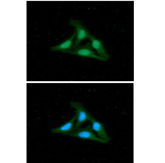 HDAC2 Antibody - ICC/IF analysis of HDAC2 in HeLa cells. The cell was stained with HDAC2 antibody (1:100).The secondary antibody (green) was used Alexa Fluor 488. DAPI was stained the cell nucleus (blue).