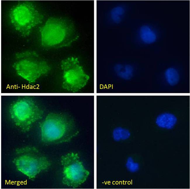 HDAC2 Antibody - Goat anti-Hdac2 (mouse) Antibody Immunofluorescence analysis of paraformaldehyde fixed U251 cells, permeabilized with 0.15% Triton. Primary incubation 1hr (10ug/ml) followed by Alexa Fluor 488 secondary antibody (2ug/ml), showing nuclear staining. The nuclear stain is DAPI (blue). Negative control: Unimmunized goat IgG (10ug/ml) followed by Alexa Fluor 488 secondary antibody (2ug/ml).