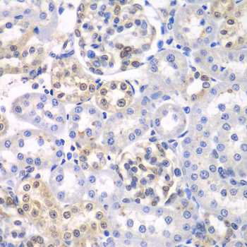 HDAC2 Antibody - Immunohistochemistry of paraffin-embedded rat kidney tissue.