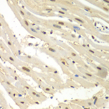 HDAC2 Antibody - Immunohistochemistry of paraffin-embedded mouse heart.