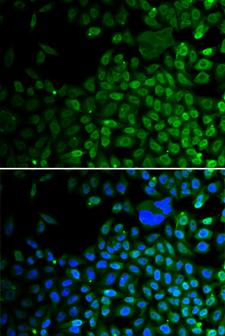 HDAC2 Antibody - Immunofluorescence analysis of A549 cells.