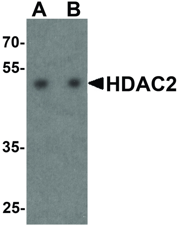 HDAC2 Antibody - Western blot analysis of HDAC2 in HeLa cell lysate with HDAC2 antibody at (A) 0.5 and (B) 1 ug/ml.