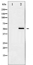 HDAC2 Antibody - Western blot of HDAC2 expression in HeLa whole cell lysates,The lane on the left is treated with the antigen-specific peptide.