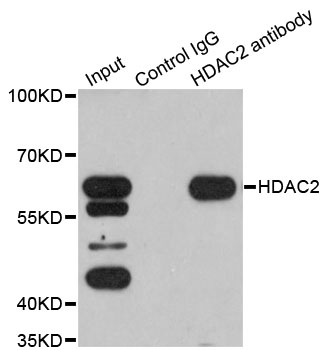 HDAC2 Antibody - Immunoprecipitation analysis of 200ug extracts of K562 cells.