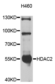 HDAC2 Antibody - Western blot analysis of extracts of H460 cells, using HDAC2 antibody at 1:1000 dilution. The secondary antibody used was an HRP Goat Anti-Rabbit IgG (H+L) at 1:10000 dilution. Lysates were loaded 25ug per lane and 3% nonfat dry milk in TBST was used for blocking. An ECL Kit was used for detection and the exposure time was 10s.