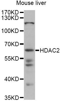 HDAC2 Antibody - Western blot analysis of extracts of mouse liver, using HDAC2 antibody at 1:1000 dilution. The secondary antibody used was an HRP Goat Anti-Rabbit IgG (H+L) at 1:10000 dilution. Lysates were loaded 25ug per lane and 3% nonfat dry milk in TBST was used for blocking. An ECL Kit was used for detection and the exposure time was 10s.