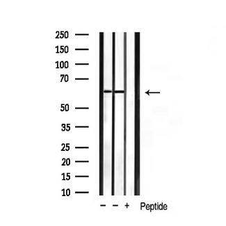 HDAC2 Antibody - Western blot analysis of extracts of various tissue sample using HDAC2 antibody.