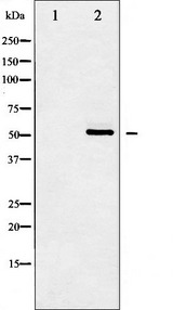 HDAC2 Antibody - Western blot analysis of HDAC2 expression in HeLa whole cells lysates. The lane on the left is treated with the antigen-specific peptide.