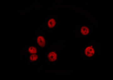 HDAC2 Antibody - Staining HeLa cells by IF/ICC. The samples were fixed with PFA and permeabilized in 0.1% Triton X-100, then blocked in 10% serum for 45 min at 25°C. The primary antibody was diluted at 1:200 and incubated with the sample for 1 hour at 37°C. An Alexa Fluor 594 conjugated goat anti-rabbit IgG (H+L) antibody, diluted at 1/600, was used as secondary antibody.