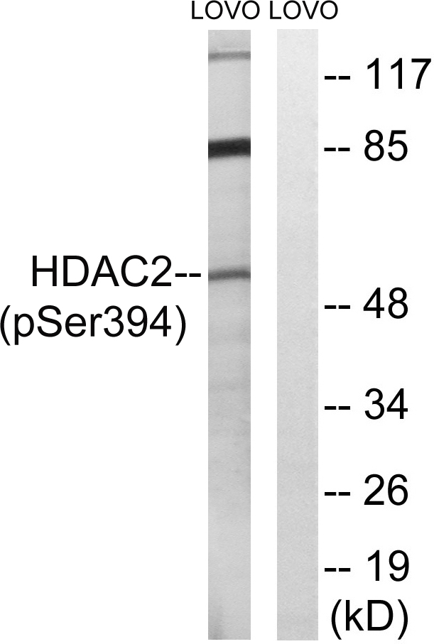 HDAC2 Antibody - Western blot analysis of lysates from LOVO cells, using HDAC2 (Phospho-Ser394) Antibody. The lane on the right is blocked with the phospho peptide.