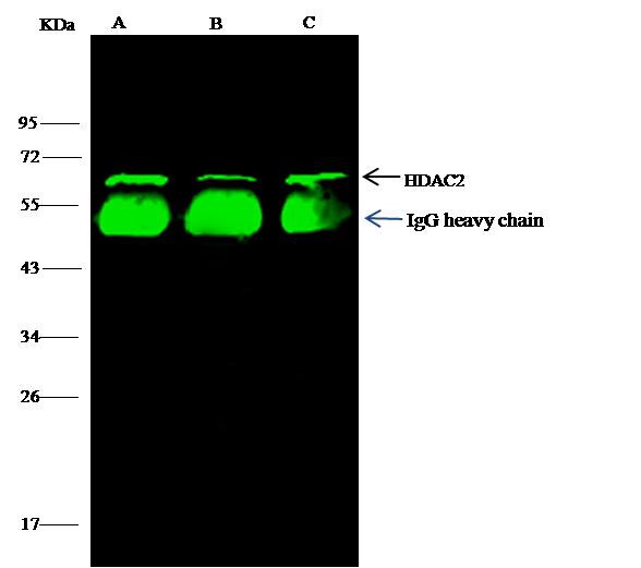 HDAC2 Antibody - HDAC2 was immunoprecipitated using: Lane A: 0.5 mg Jurkat Whole Cell Lysate. Lane B: 0.5 mg NIH-3T3 Whole Cell Lysate. Lane C:0.5 mg Hela Whole Cell Lysate. 4 uL anti-HDAC2 rabbit polyclonal antibody and 15 ul of 50% Protein G agarose. Primary antibody: Anti-HDAC2 rabbit polyclonal antibody, at 1:100 dilution. Secondary antibody: Dylight 800-labeled antibody to rabbit IgG (H+L), at 1:5000 dilution. Developed using the odssey technique. Performed under reducing conditions. Predicted band size: 60 kDa. Observed band size: 60 kDa.