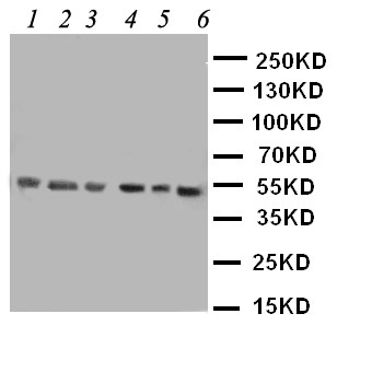 HDAC3 Antibody - WB of HDAC3 antibody. Lane 1: Rat Stomach Tissue Lysate. Lane 2: Rat Testis Tissue Lysate. Lane 3: MCF-7 Cell Lysate. Lane 4: HELA Cell Lysate. Lane 5: JURKAT Cell Lysate. Lane 6: SKOV Cell Lysate.
