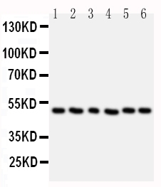 HDAC3 Antibody - Western blot analysis of HDAC3 using anti-HDAC3 antibody. Electrophoresis was performed on a 5-20% SDS-PAGE gel at 70V (Stacking gel) / 90V (Resolving gel) for 2-3 hours. The sample well of each lane was loaded with 50ug of sample under reducing conditions. Lane 1: Rat Stomach Tissue Lysate Lane 2: Rat Testis Tissue Lysate Lane 3: MCF-7 Cell Lysate Lane 4: HELA Cell Lysate Lane 5: JURKAT Cell Lysate Lane 6: SKOV Cell Lysate After Electrophoresis, proteins were transferred to a Nitrocellulose membrane at 150mA for 50-90 minutes. Blocked the membrane with 5% Non-fat Milk/ TBS for 1.5 hour at RT. The membrane was incubated with rabbit anti-HDAC3 antigen affinity purified polyclonal antibody at 0.5 µg/mL overnight at 4°C, then washed with TBS-0.1% Tween 3 times with 5 minutes each and probed with a goat anti-rabbit IgG-HRP secondary antibody at a dilution of 1:10000 for 1.5 hour at RT. The signal is developed using an Enhanced Chemiluminescent detection (ECL) kit with Tanon 5200 system.