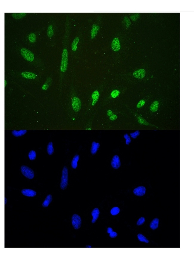 HDAC3 Antibody - IF analysis of HDAC3 using anti-HDAC3 antibody HDAC3 was detected in immunocytochemical section of U20S cell. Enzyme antigen retrieval was performed using IHC enzyme antigen retrieval reagent for 15 mins. The tissue section was blocked with 10% goat serum. The tissue section was then incubated with 2µg/mL rabbit anti-HDAC3 Antibody overnight at 4°C. DyLight®488 Conjugated Goat Anti-Rabbit IgG was used as secondary antibody at 1:100 dilution and incubated for 30 minutes at 37°C. The section was counterstained with DAPI. Visualize using a fluorescence microscope and filter sets appropriate for the label used.