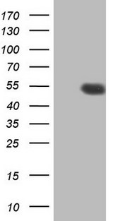HDAC3 Antibody - HEK293T cells were transfected with the pCMV6-ENTRY control (Left lane) or pCMV6-ENTRY HDAC3 (Right lane) cDNA for 48 hrs and lysed. Equivalent amounts of cell lysates (5 ug per lane) were separated by SDS-PAGE and immunoblotted with anti-HDAC3.