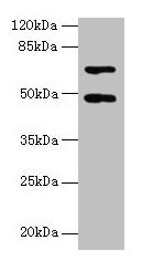 HDAC3 Antibody - Western blot All lanes: Histone deacetylase 3 antibody at 2µg/ml + Hela cells Secondary Goat polyclonal to rabbit IgG at 1/10000 dilution Predicted band size: 49, 50 kDa Observed band size: 49 kDa