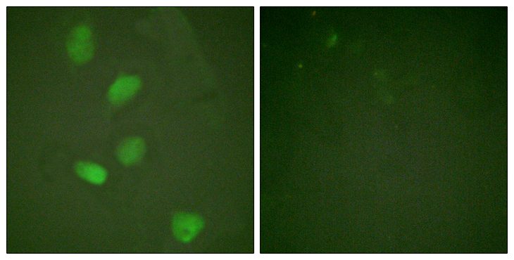 HDAC3 Antibody - Immunofluorescence analysis of HeLa cells, using HDAC3 Antibody. The picture on the right is blocked with the synthesized peptide.