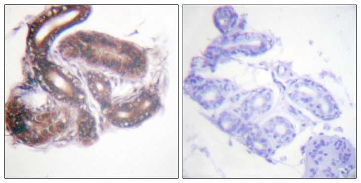 HDAC3 Antibody - Immunohistochemistry analysis of paraffin-embedded human skin tissue, using HDAC3 Antibody. The picture on the right is blocked with the synthesized peptide.