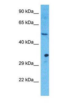 HDAC3 Antibody - Western blot of HDAC3 Antibody with human 721_B Whole Cell lysate.  This image was taken for the unconjugated form of this product. Other forms have not been tested.