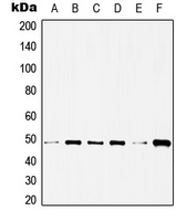 HDAC3 Antibody - Western blot analysis of Histone Deacetylase 3 expression in HeLa (A); C32 (B); NIH3T3 (C); Raw264.7 (D); PC12 (E); rat heart (F) whole cell lysates.