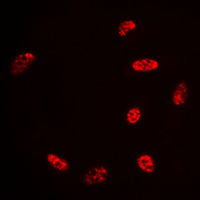 HDAC3 Antibody - Immunofluorescent analysis of Histone Deacetylase 3 staining in HeLa cells. Formalin-fixed cells were permeabilized with 0.1% Triton X-100 in TBS for 5-10 minutes and blocked with 3% BSA-PBS for 30 minutes at room temperature. Cells were probed with the primary antibody in 3% BSA-PBS and incubated overnight at 4 C in a humidified chamber. Cells were washed with PBST and incubated with a DyLight 594-conjugated secondary antibody (red) in PBS at room temperature in the dark. DAPI was used to stain the cell nuclei (blue).